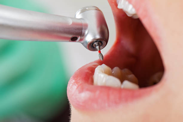 Best Emergency Treatment for Dental Infections or Abscesses in Rio Dell, CA